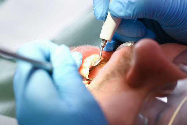 Best Emergency Treatment for Dental Infections or Abscesses in Portland, TN